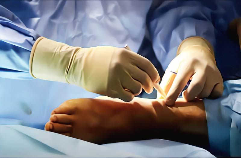 cirugía mínimanete invasiva