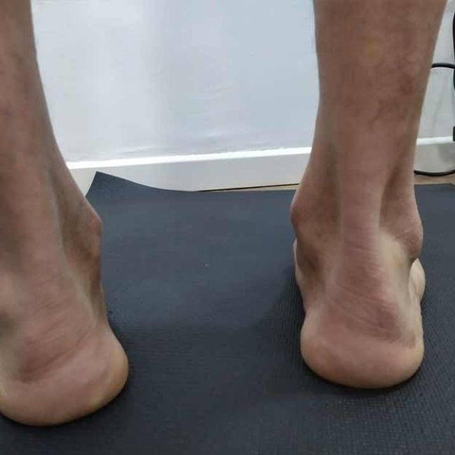 Estudio de la pisada