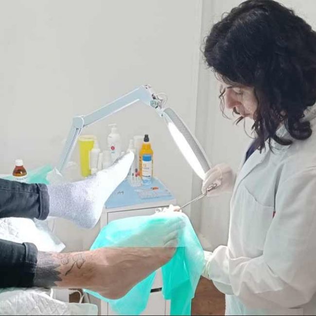 Reconstrucción de uñas